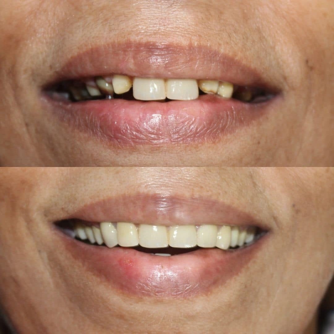smile gallery